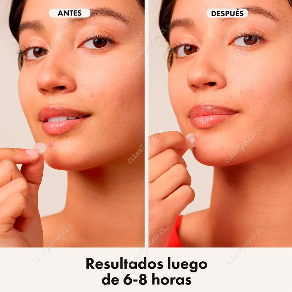 parche-antiacne-mighty-patch-hero-invisible-24-un-(2)